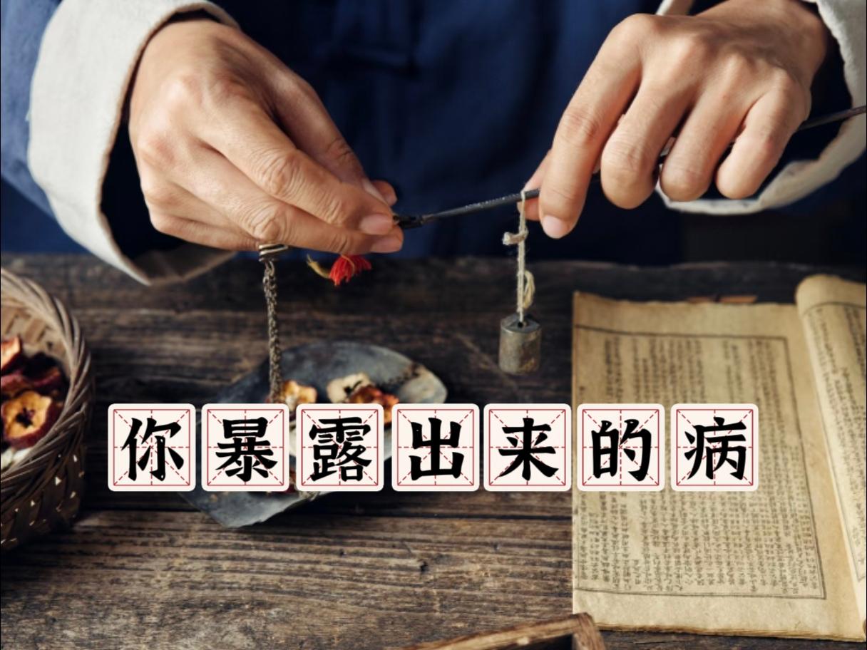 你暴露出来的病1. 刷牙出血、牙龈萎缩、舌有齿痕：多为脾虚，脾不统血所致！