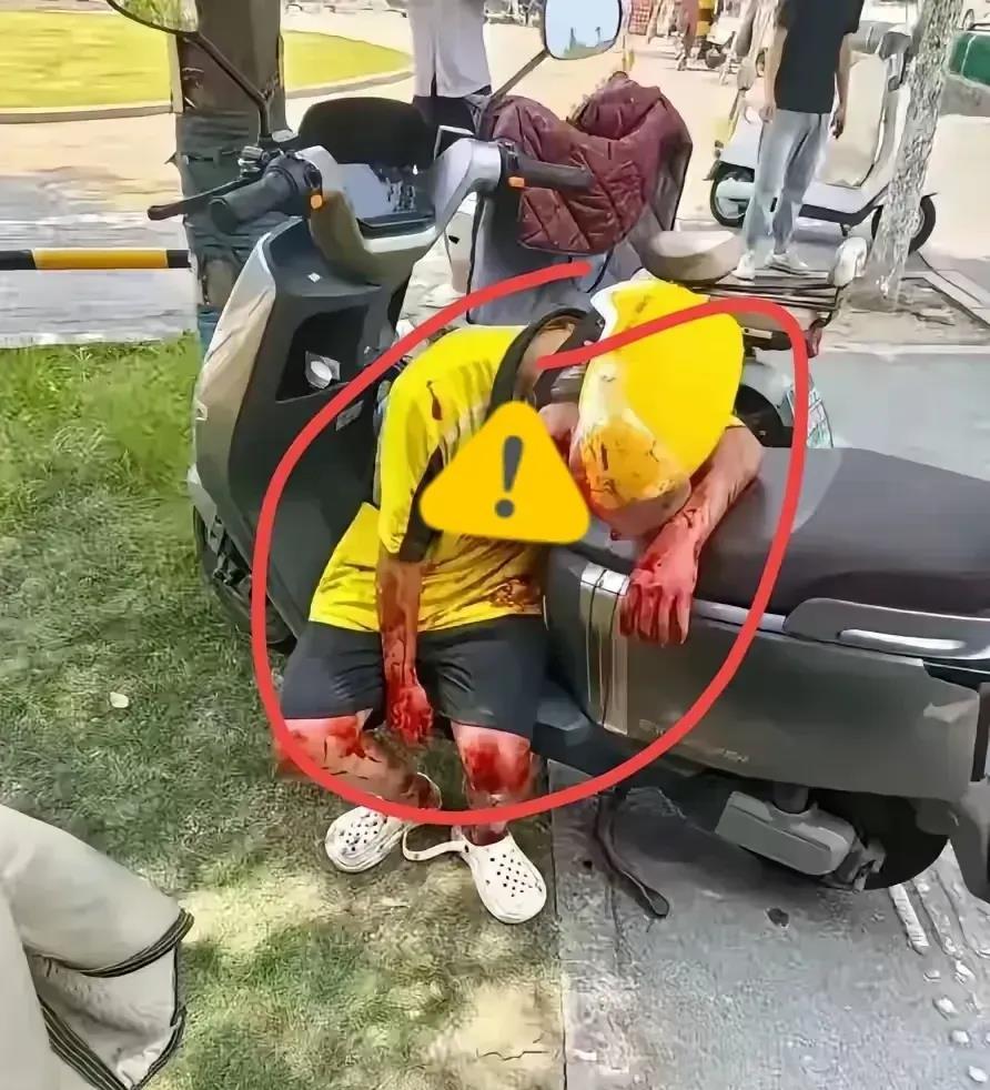 外卖订单超时九分三十八秒深圳龙华城中村监控拍到那个摔破膝盖的骑手