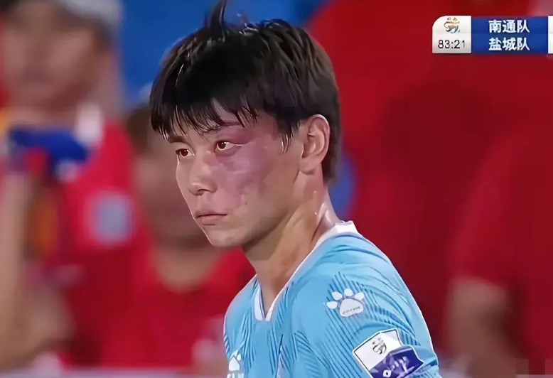 苏超青面兽庞志超和中国男足大佬郑智，虽然双方都是怒目圆灯，但是他们怒目圆瞪的对象
