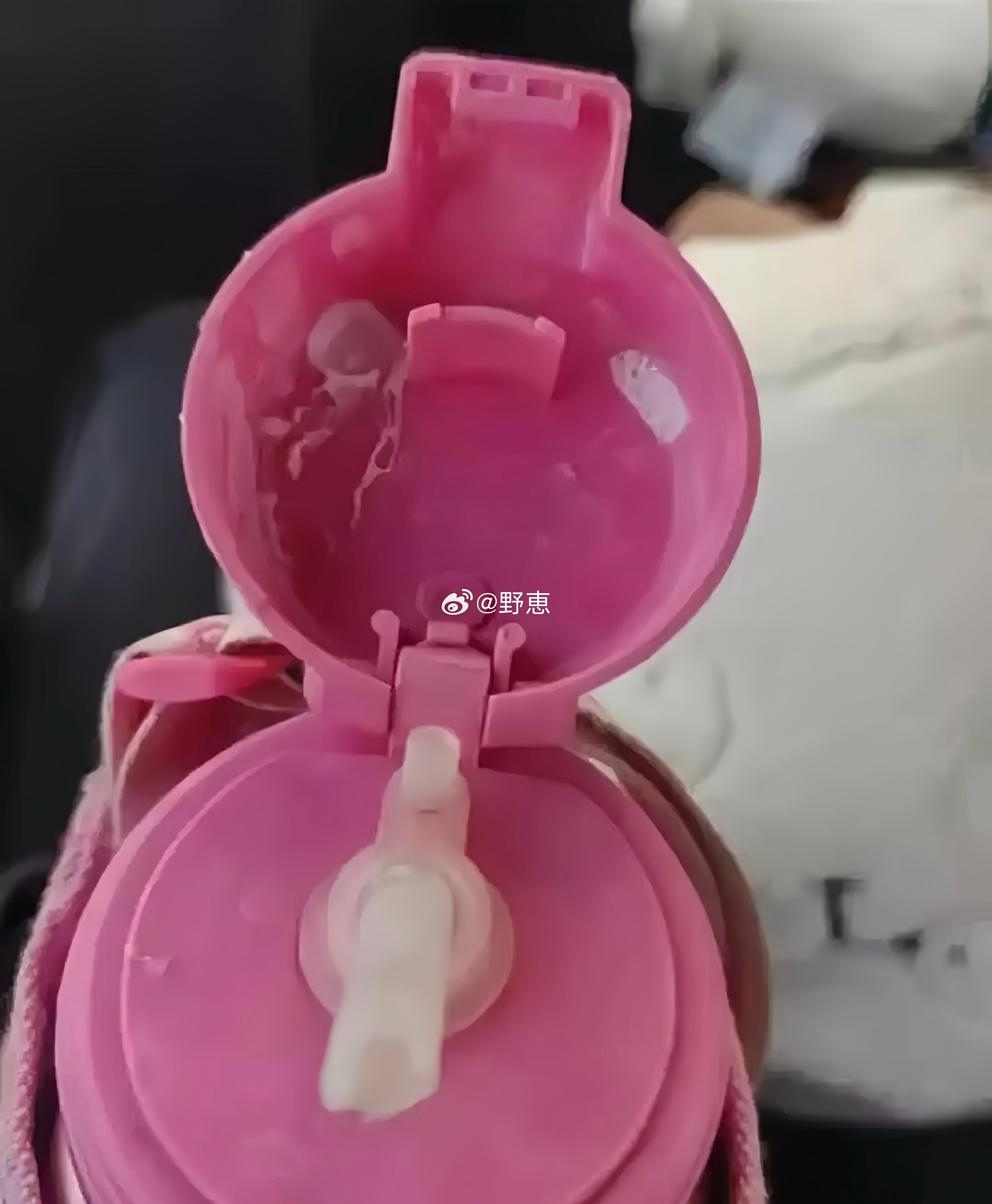 才上一年级，还好发现得早。