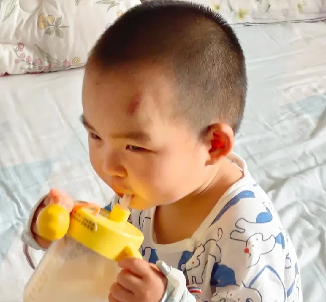 太过分了，邻居奶奶爷爷，给自己儿子看孩子，不小心把孩子摔了，把孩子锁骨骨折了！孩