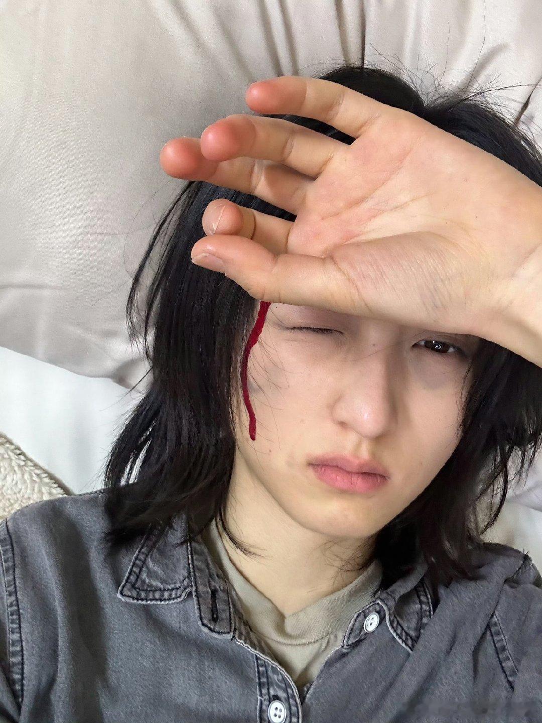 张子枫战损妆live图张子枫伤痕妆张子枫的伤痕妆live图，逼真的伤痕让人