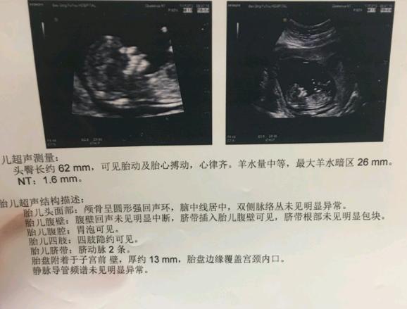 头胎如愿生下了可爱的男宝宝, 顺产6.7斤, 可爱男宝谁接谁中