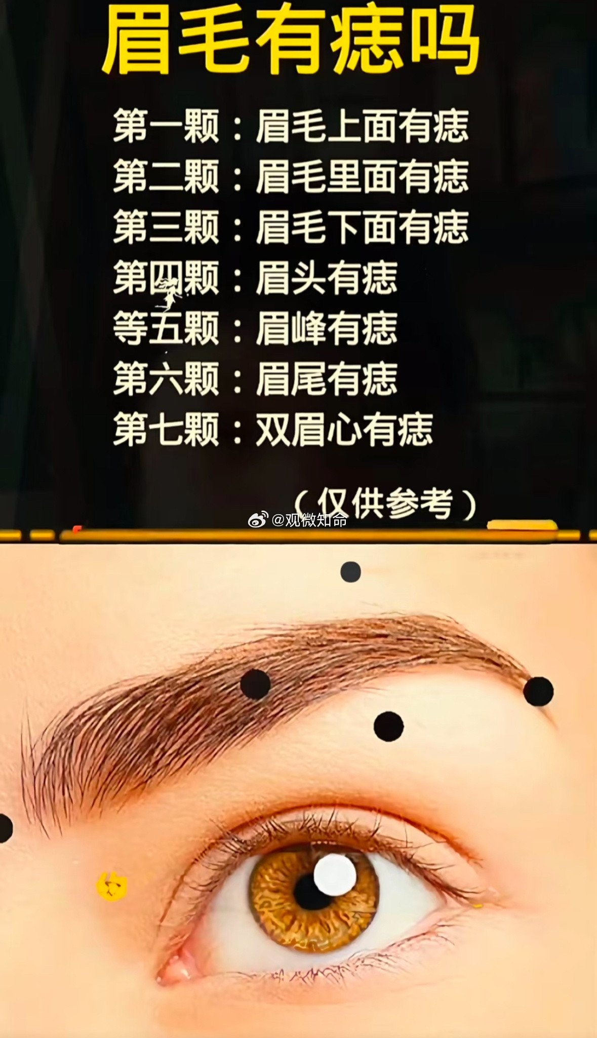 眉眼周遭对应田宅宫、福德宫，痣位暗藏缘分与福运🍃1.眉毛里藏痣：眉里藏珠，财