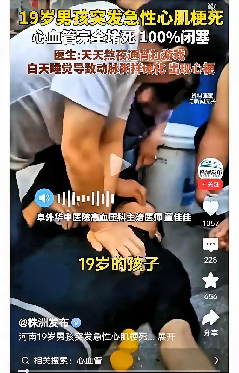 湖南株洲19岁男孩突发急性心肌梗死，心血管完全堵死100％闭塞，去医院检查医生