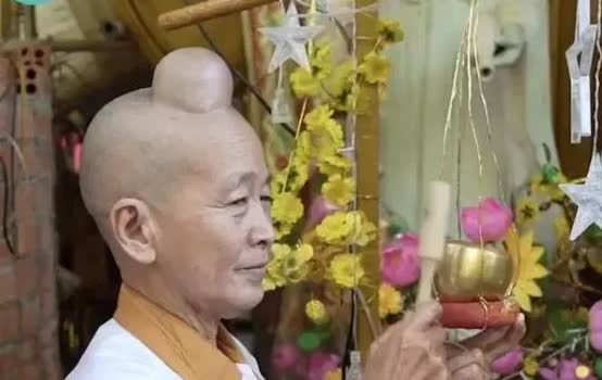越南有个女子，一出生头顶就长了一个跟佛主一样的肉髻，一天，她联系医生要割掉肉髻，