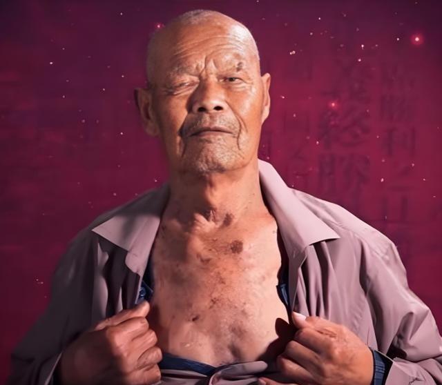 1956年，35岁的农民咳嗽10年，但却一直拒绝就医，一天，他突然用力一咳，一个