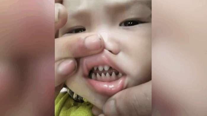 实拍: 宝宝长了满口鲨鱼牙, 网友却被大人的手指激怒! 为什么?