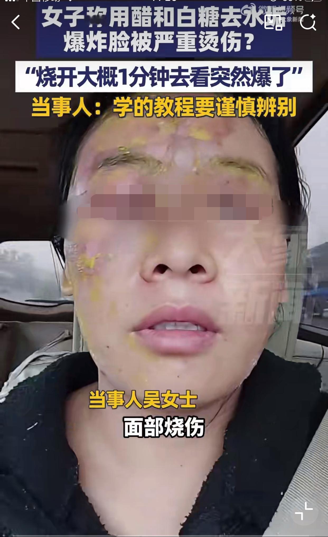 真是太危险了，大家一定不要盲目去尝试！近日河北邯郸，一女子家中的电水壶使用时间长