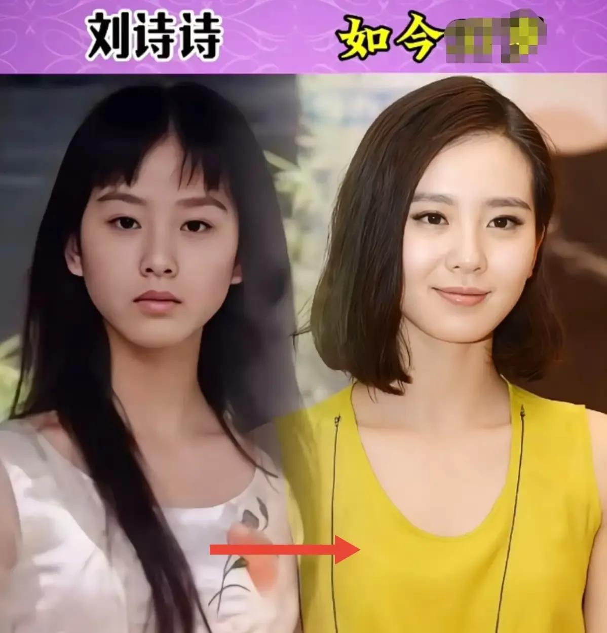 惊！惊！9位女明星之前的素颜与如今的靓照对比：素颜照最美的要数玉颜如春的刘诗诗了