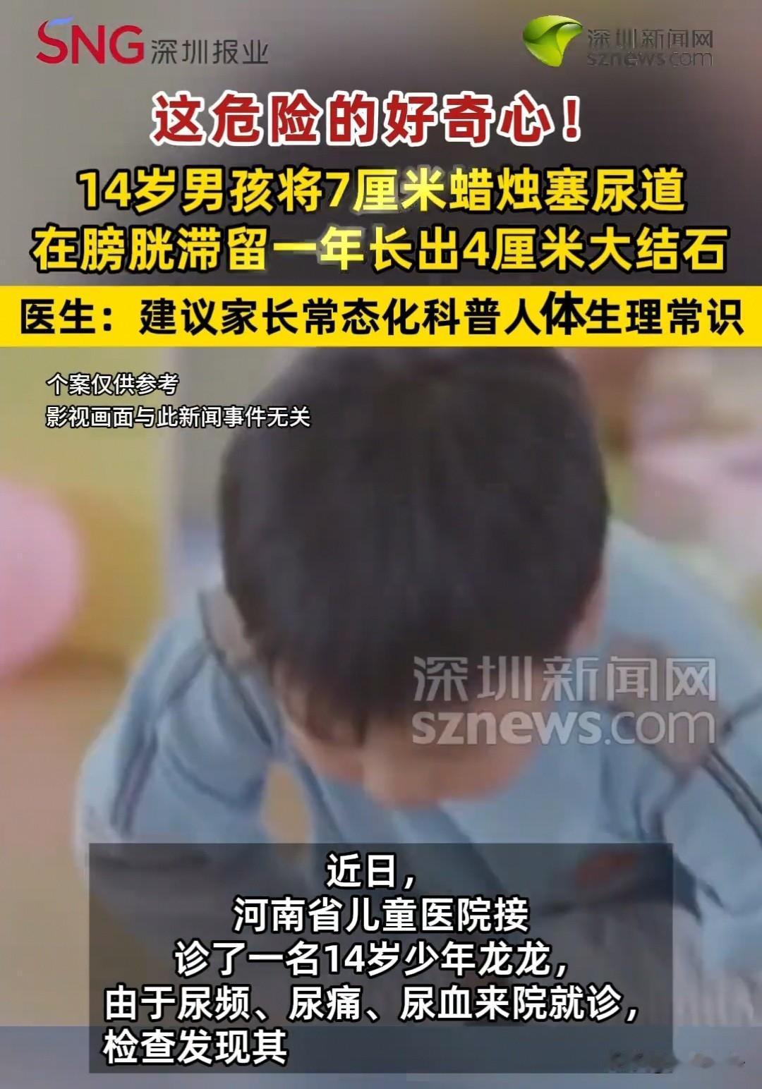 河南，14岁的小男孩，把七厘米的生日蜡烛，插入了尿道、进入了膀胱。结果，一年后蜡