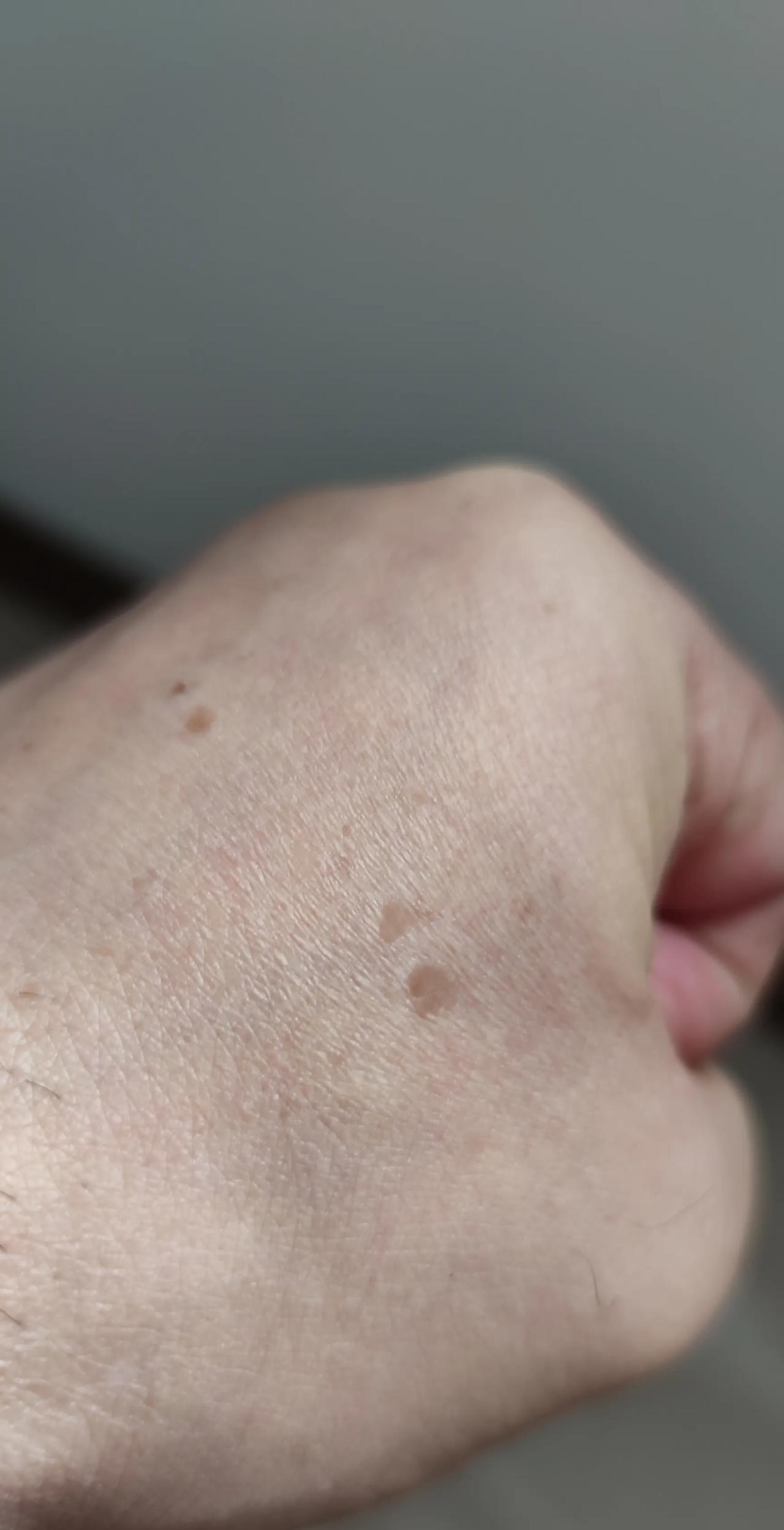 当你的手上，出现这样的斑点时候，就说明你开始步入老年了。它一般四十八九岁时出现，