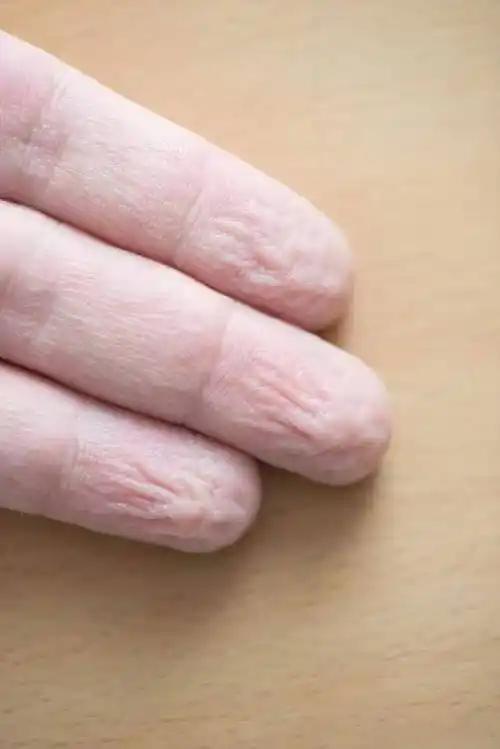 为什么手指泡水后会起皱，是伤害还是保护?很多人第一次注意到这种变化时，会担心