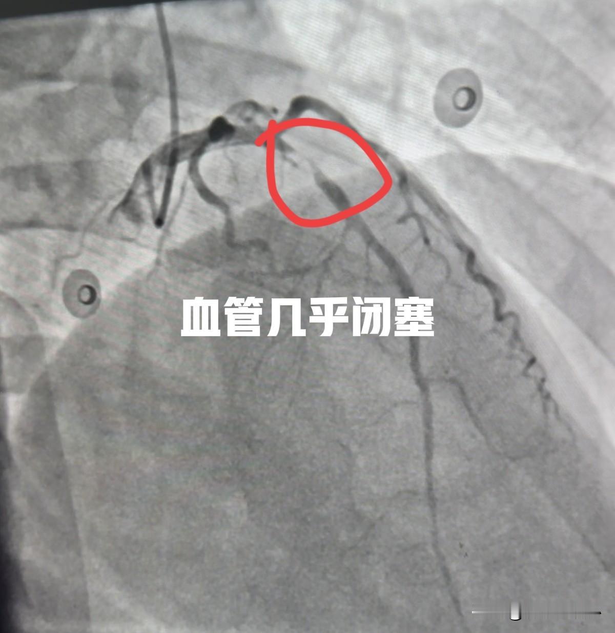40岁女性，最近1周出血剑突下疼痛，就是心口窝那里，持续性疼痛，开始以为是