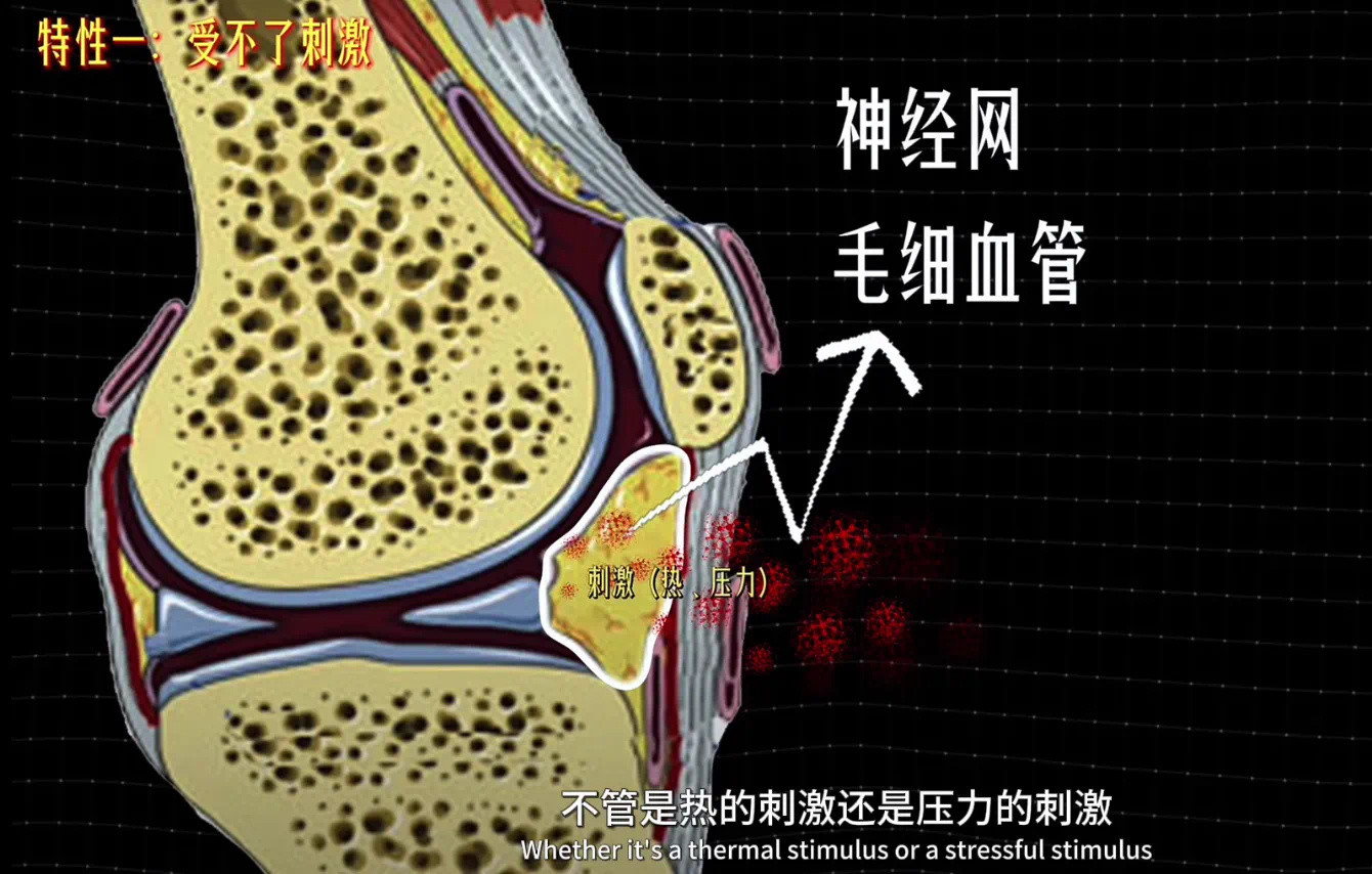 膝关节损伤【脂肪垫炎】你的膝盖下方有没有两坨软软的肉？长时间活动后会出现疼痛和