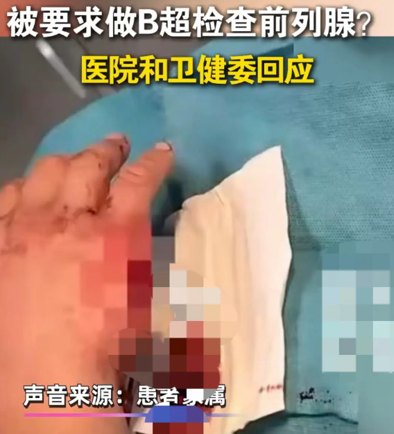 34岁男子手部划伤，医院要求做B超查前列腺？医院和卫健委回应！近日，江苏的朱