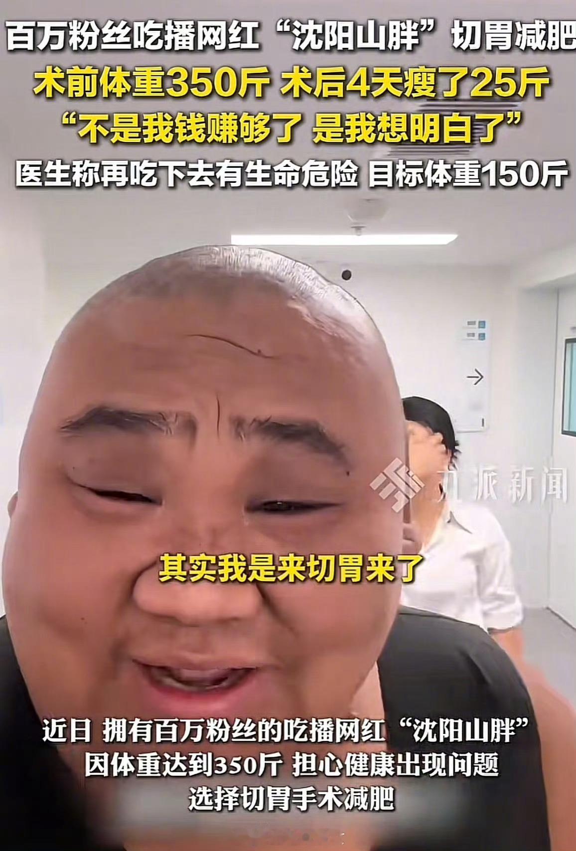 百万粉丝吃播网红切胃百万粉丝吃播网红切胃减肥：术前体重350斤，术后4天瘦了25