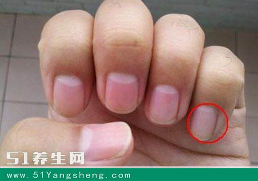 肾不好的五大信号, 你中了几个? 千万别大意