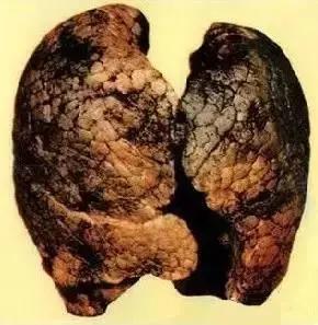 每天做三顿饭，肺癌风险高2.1倍？真不是吓唬人，罪魁祸首是油烟！最近很多人