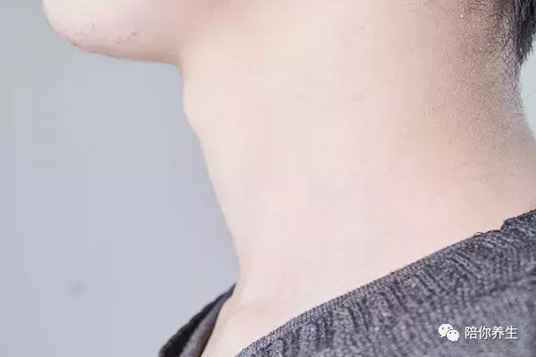 脖子一转就“咔咔”响怎么回事 可能是疾病造成的