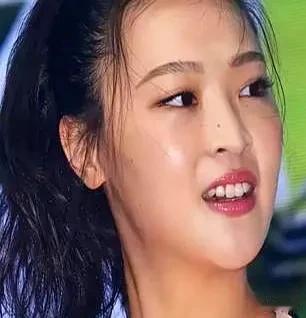 前女排队长惠若琪婚后两年怀不上孩子，去医院一查，才知道是当年为了拿奥运金牌做心脏