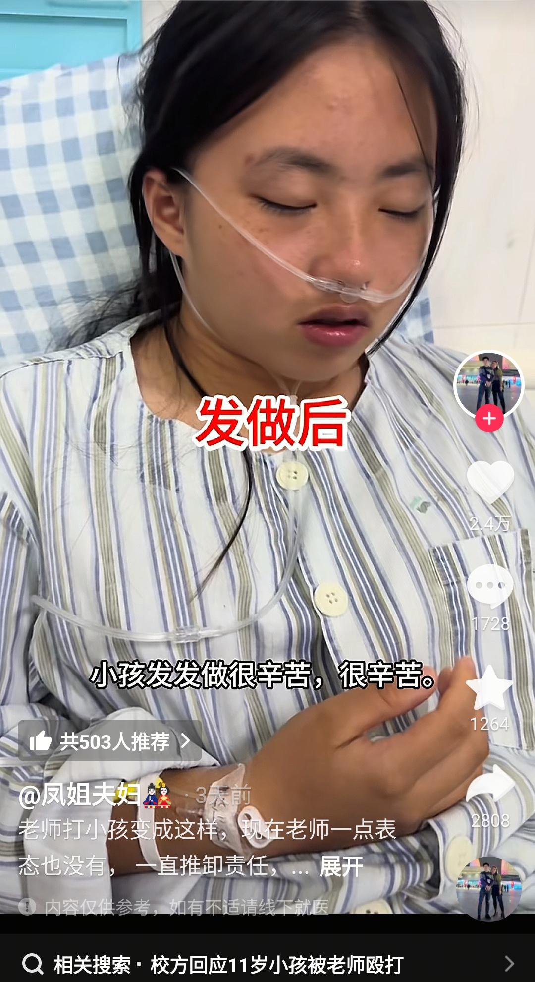 太狠了！广东湛江，这名中学女生，就因为班里同学吵闹，但自己啥也没干，就被老师打到