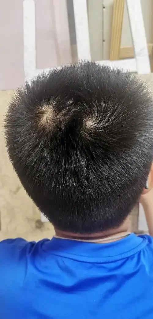 孩子头上两个旋说明什么？民间对孩子头上有两个旋说法众多，比如“二