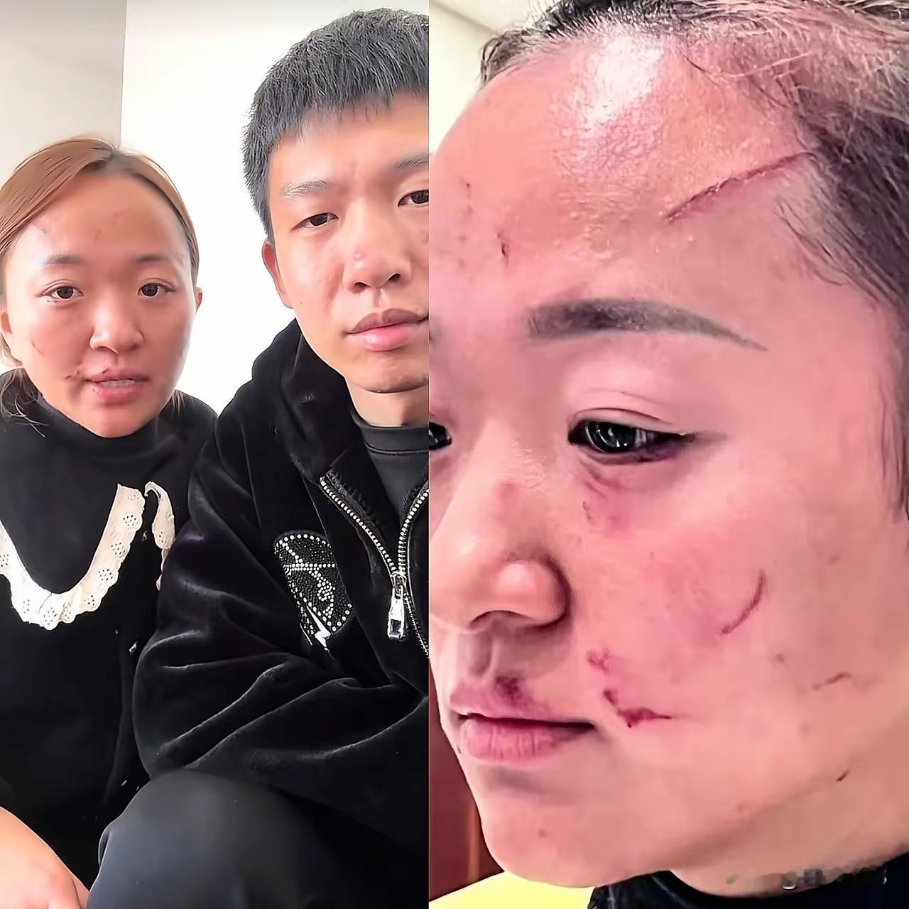 婆婆被网友骂惨了，婆媳打架后续！12月7日曝光的河南婆媳打架事件有了后续。经民