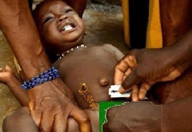 在非洲部分地区，有一项延续了三千多年的陋习，直到今天还在伤害无数女孩，它就是女性