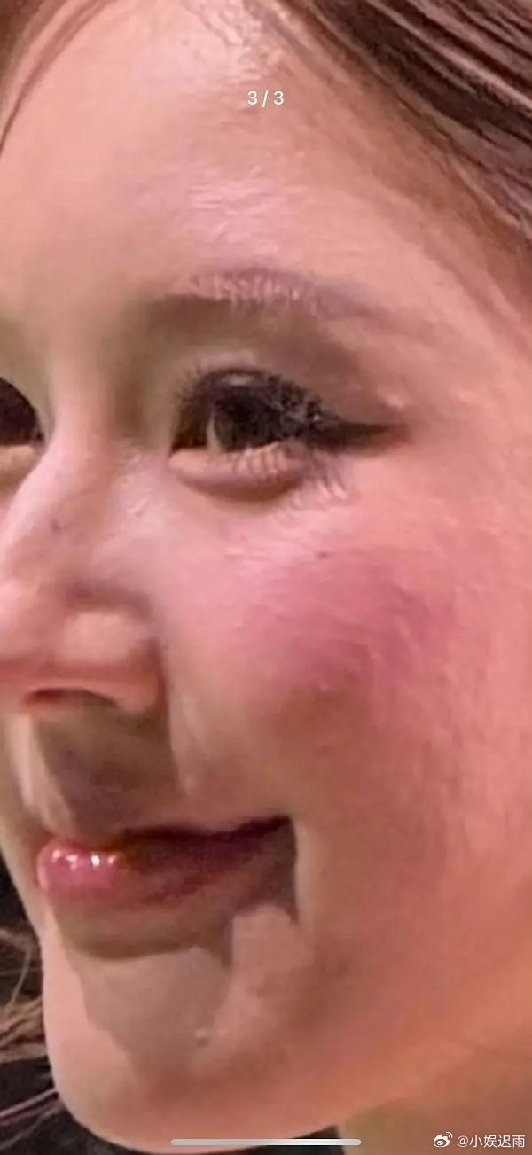 网友说麻子闭口都想坏人脸上了