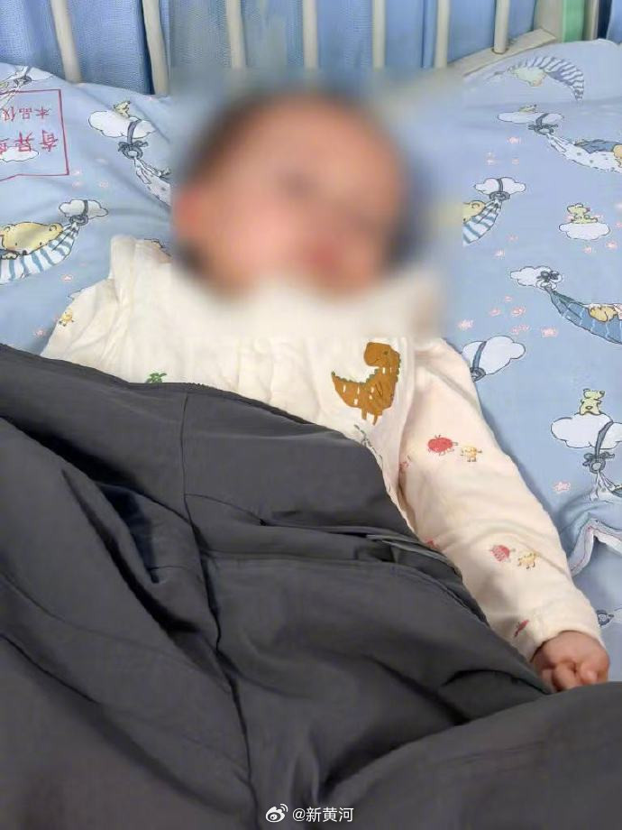 【#医院回应1岁患儿输液后死亡#】#输液后身亡患儿已尸检#近日，#1岁男童输液