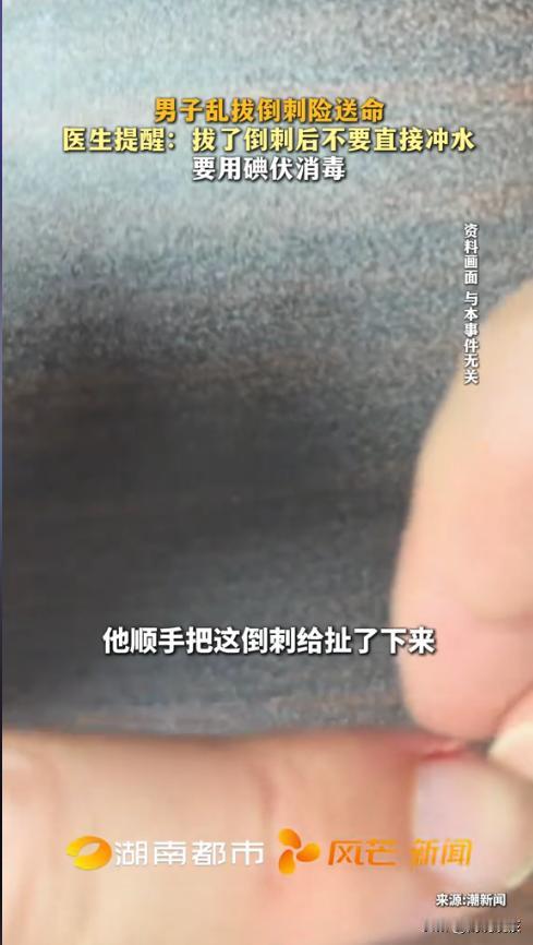 “太吓人了！”近日，一男子见手指长了倒刺，随手一拔，没想到没多久，手指就开始溃烂