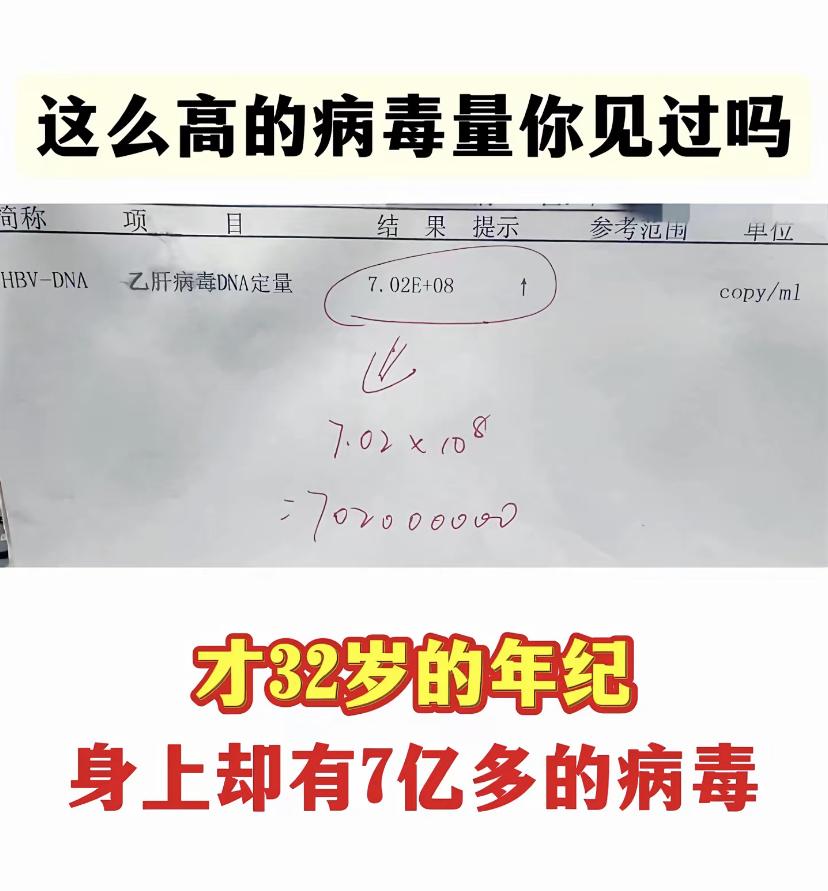 看看这位山东聊城患者的化验单。大三阳，很年轻才32岁，乙肝病毒量却到了...
