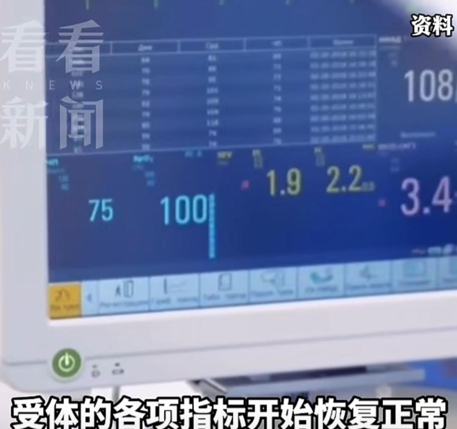 全球首创！广西一医生将整副猪肝与两颗猪肾，一次性植入一名脑死亡男子体内。短短不到