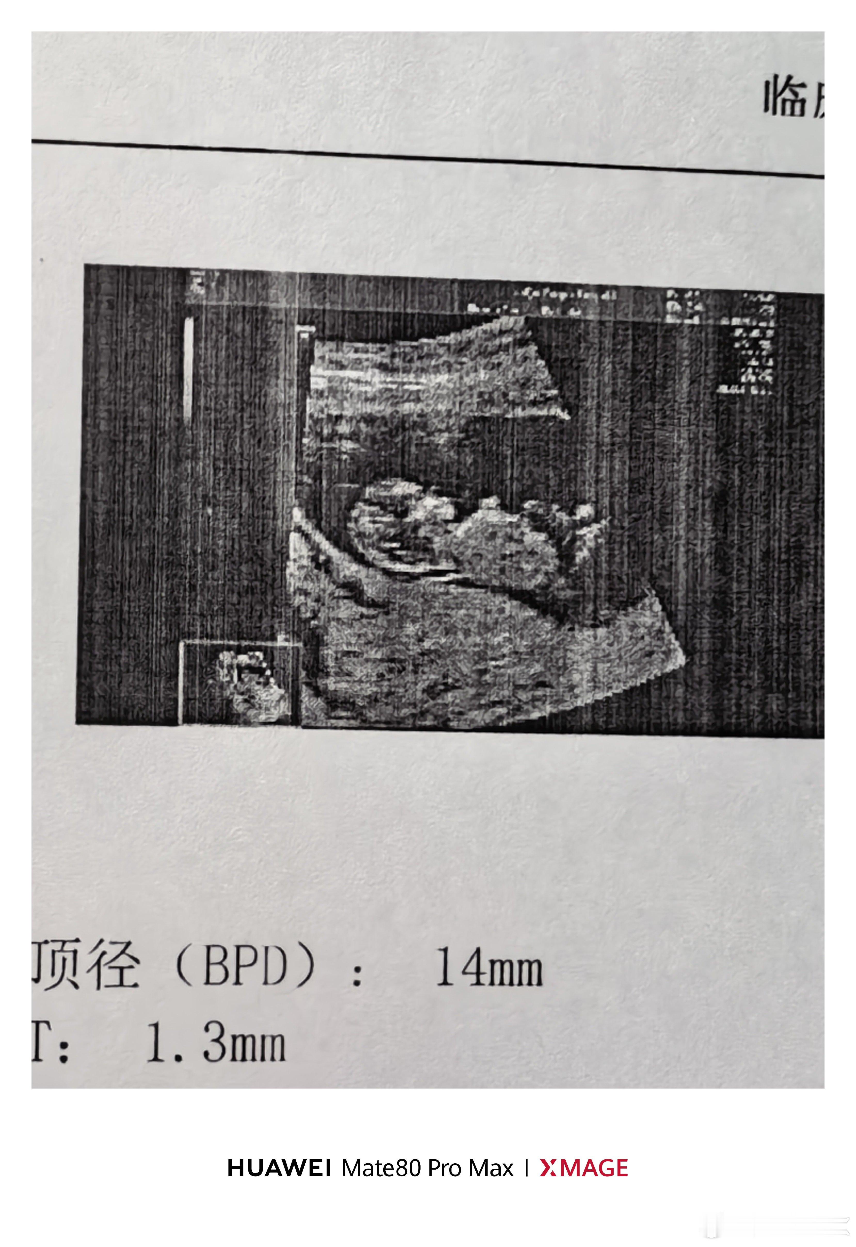 最美照片看到了小勇气