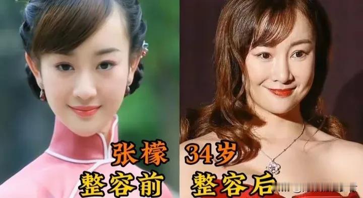 10位整容翻车女星，天然颜值才经得住时光。不少女明星年轻时五官精致，自带灵动气