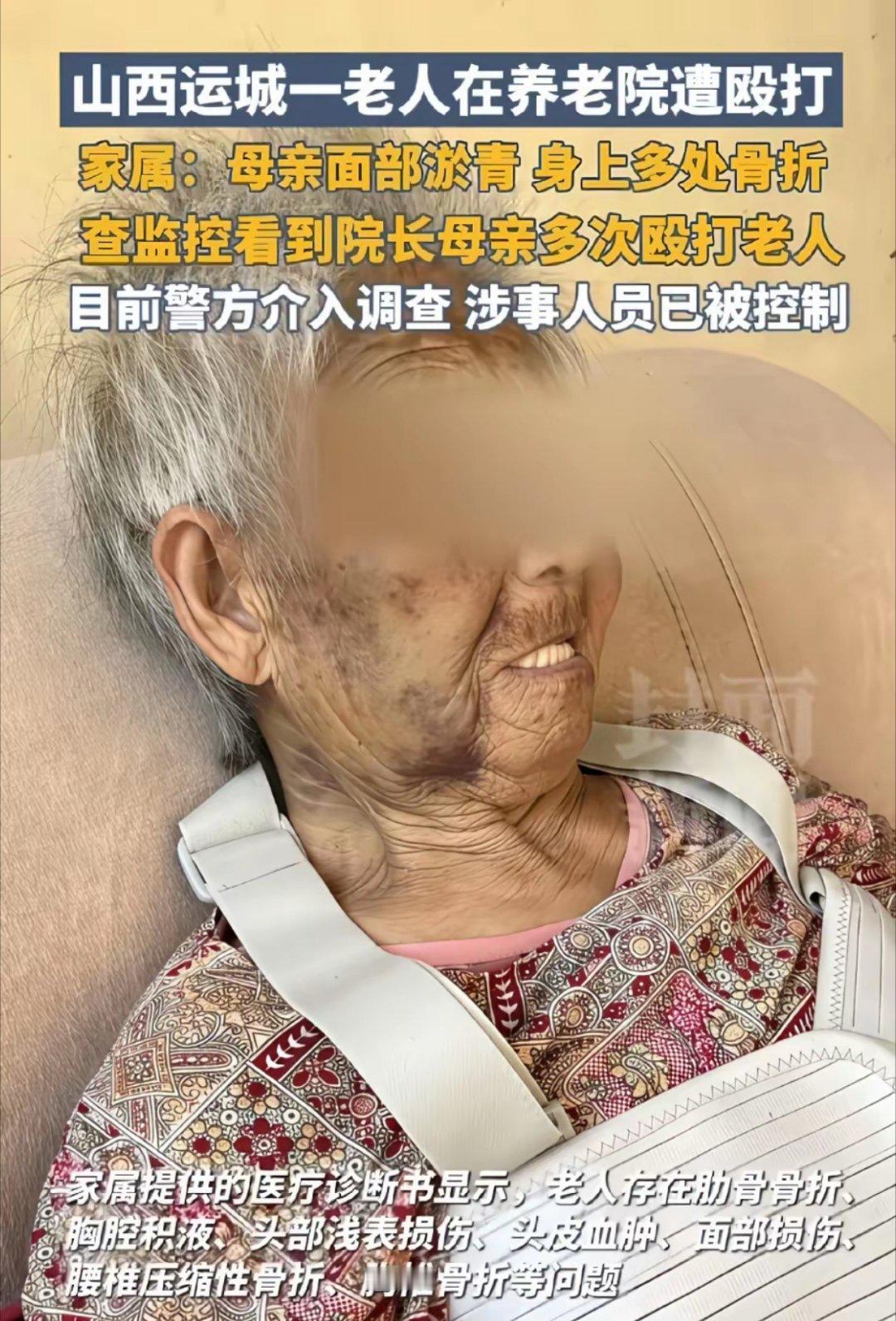 养老院成打人院，山西男子看到85岁母亲被养老院殴打的视频，当场崩溃。山西运城解某