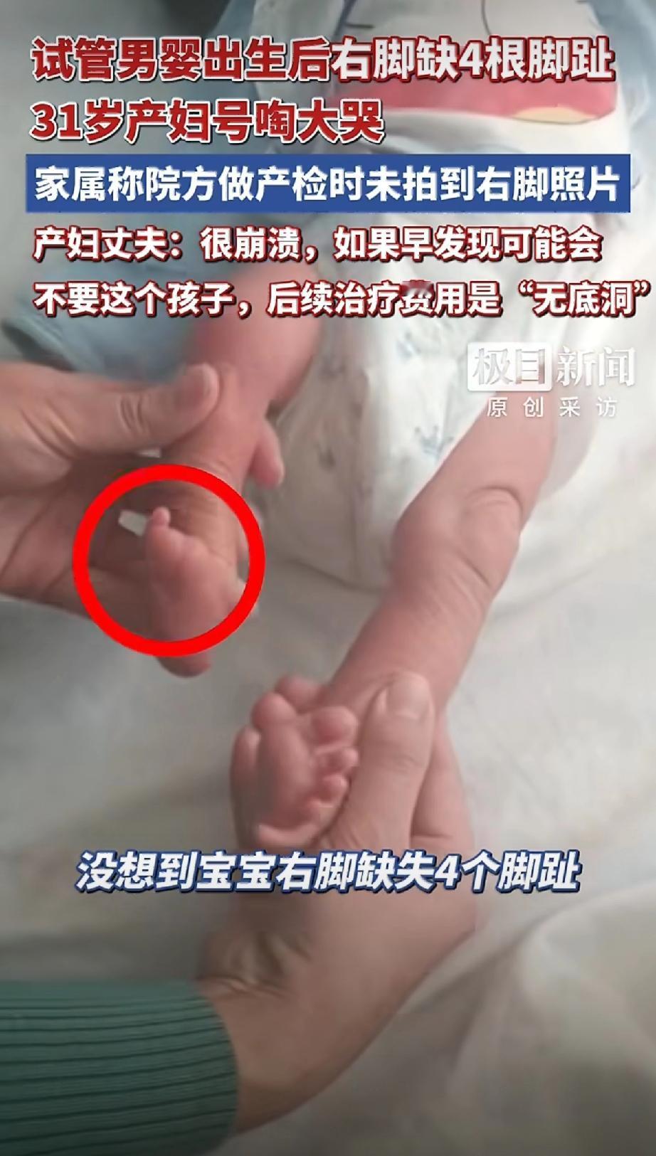 10次产检没查出缺脚趾，医院一句“不归我们查”就完事了？山东滨州这对夫妻快崩