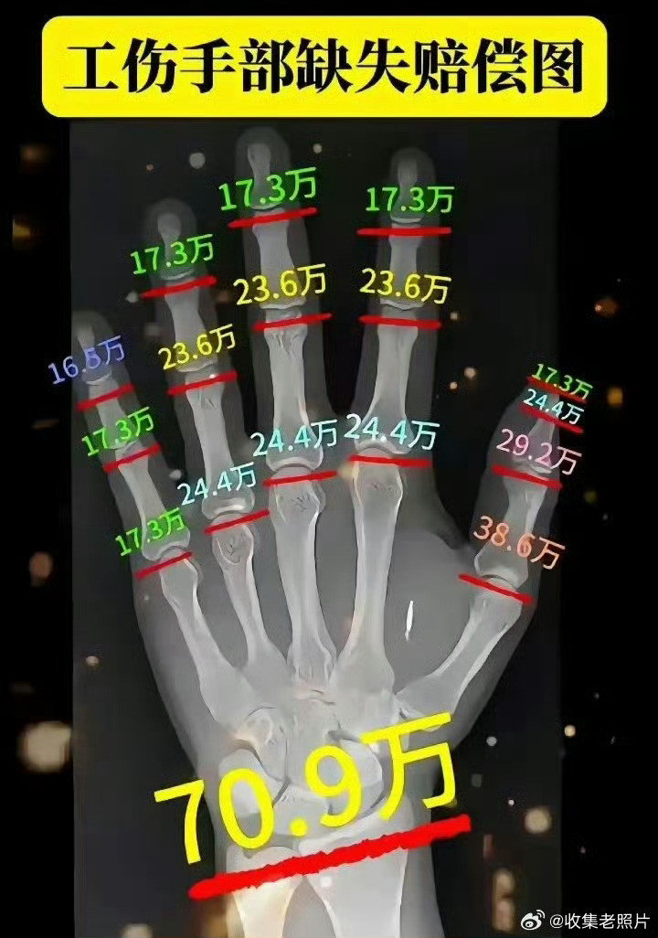 【工伤赔偿金的标准（图示）】牛马也许不值钱，但受伤的牛马很值钱。
