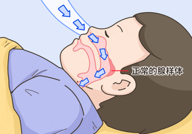孩子睡觉总打鼾怎么办？这些办法简单好用，家长们一定要知道“孩子才4岁，最