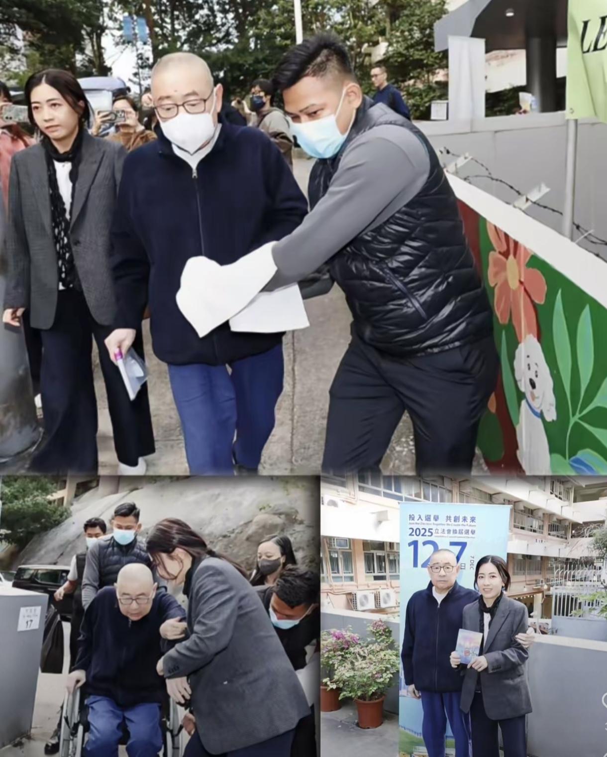 3D打印器官来了！​刘銮雄换肾8年，近几日出现排异反应，高烧40度，尿血严重。