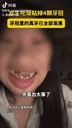 “这也太惨了！”福建一女生吃饭时，突然觉得门牙凉飕飕的，赶紧吐掉嘴里的食物——好