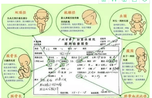教你一分钟看懂产检报告单! 竟然有这么多秘密