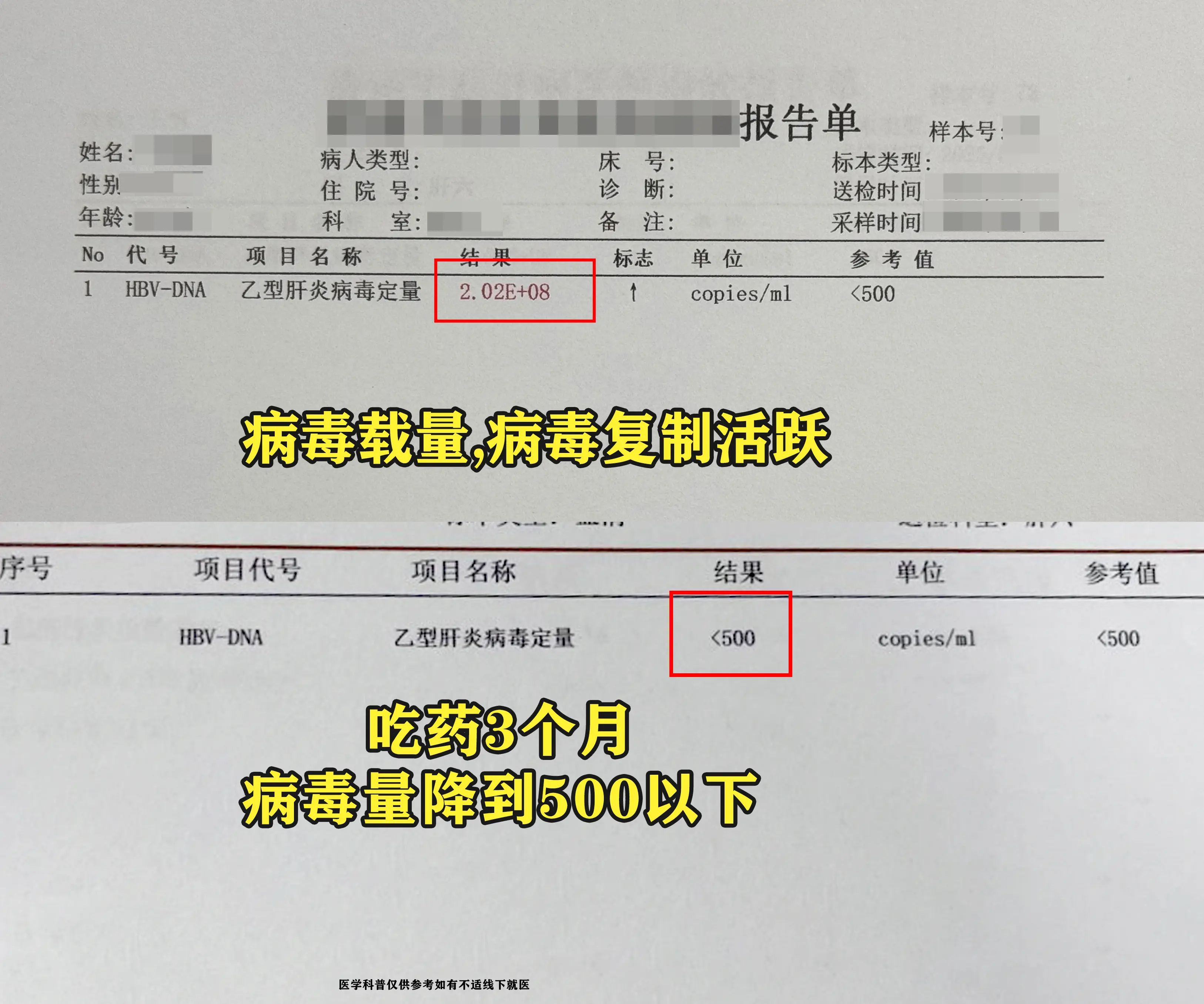 这位菏泽的乙肝患者，病毒载量上亿，肝功能明显异常，纠结一个多月后终于启...