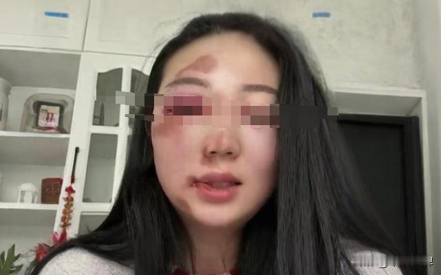 女婿昨天抬手给了女儿一巴掌，这一巴掌直接把我吓得魂飞魄散，我当场就要拼命，冲着女