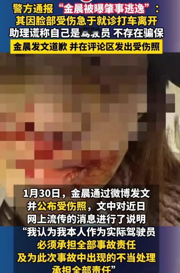 凌晨，绍兴，一声巨响。金晨为躲一条狗，失控撞墙。她脸部受伤，血流不止，但现场