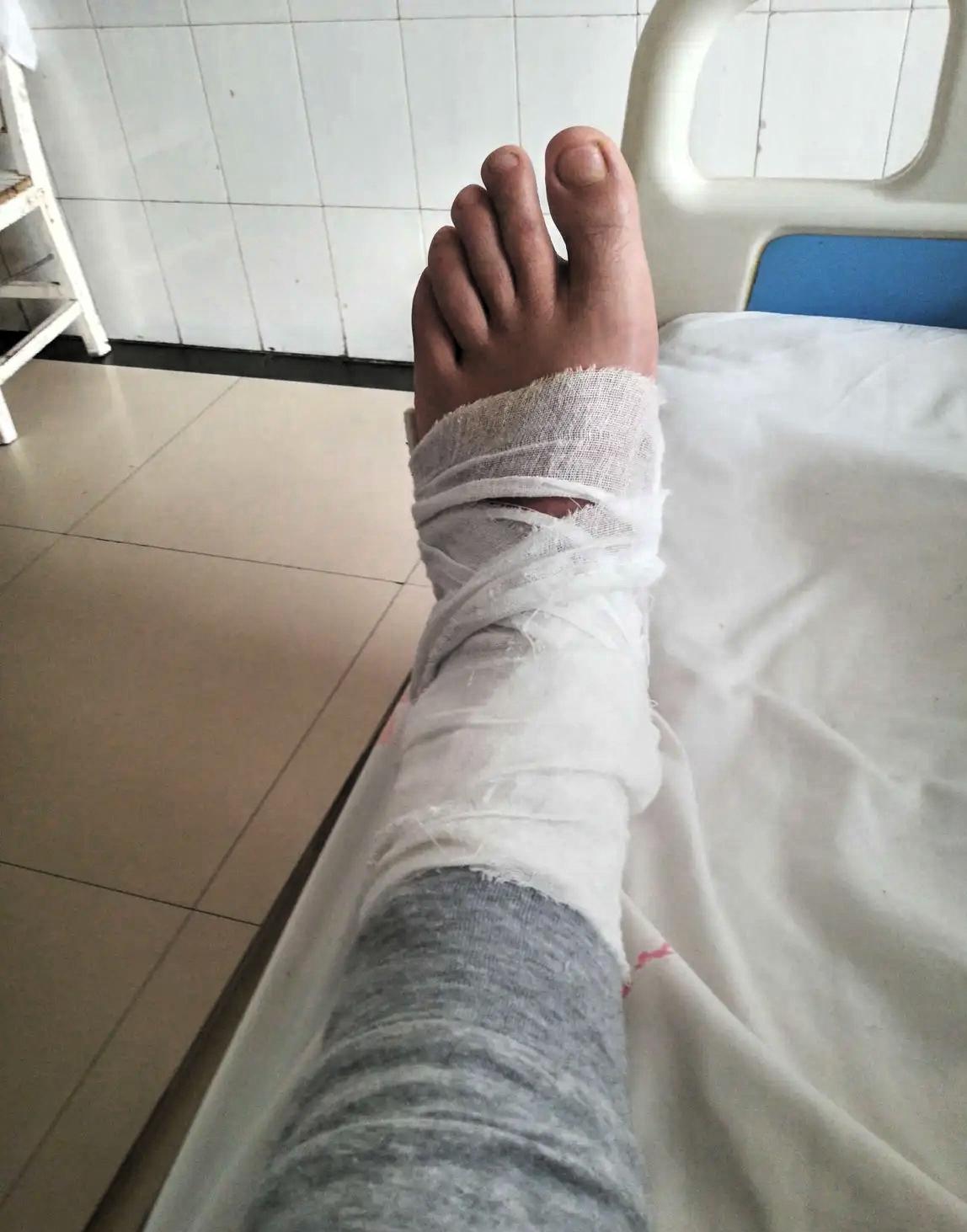 工地做临时工的朋友要明白一个道理。发生工伤了不管你有没有合同老板都会赔钱，