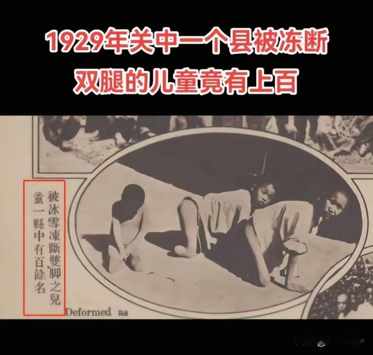 1929年关中一个县被冻断双腿的儿童竟有上百人之多，条件太艰苦了！悲惨的时代应