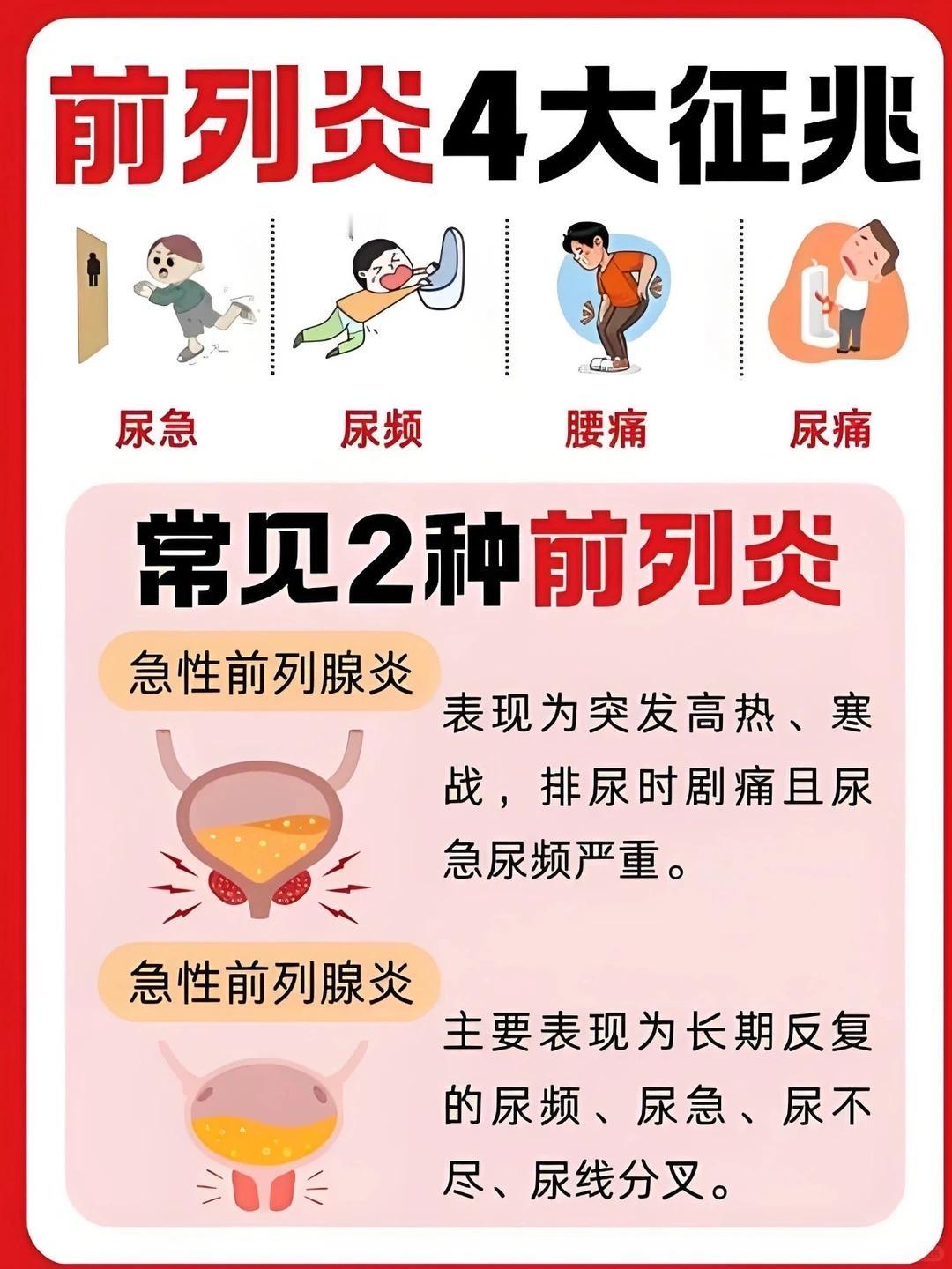 男生必看！前列腺发出的“求救信号”