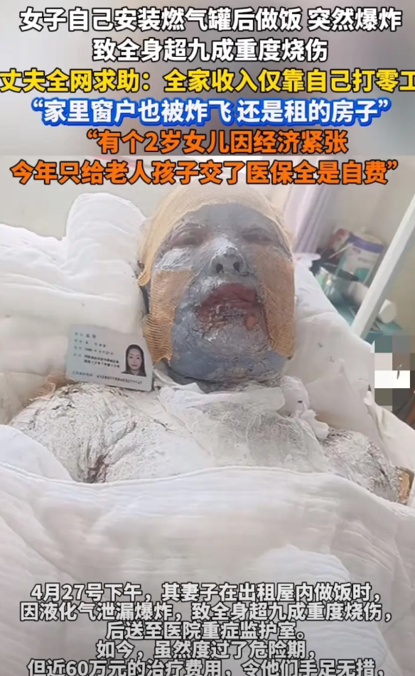 痛心！女子燃气罐爆炸致重度烧伤，家庭陷入绝境真的太让人揪心了！4月27日下午
